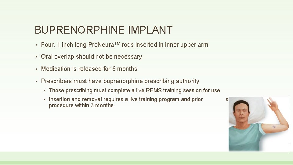 BUPRENORPHINE IMPLANT • Four, 1 inch long Pro. Neura. TM rods inserted in inner