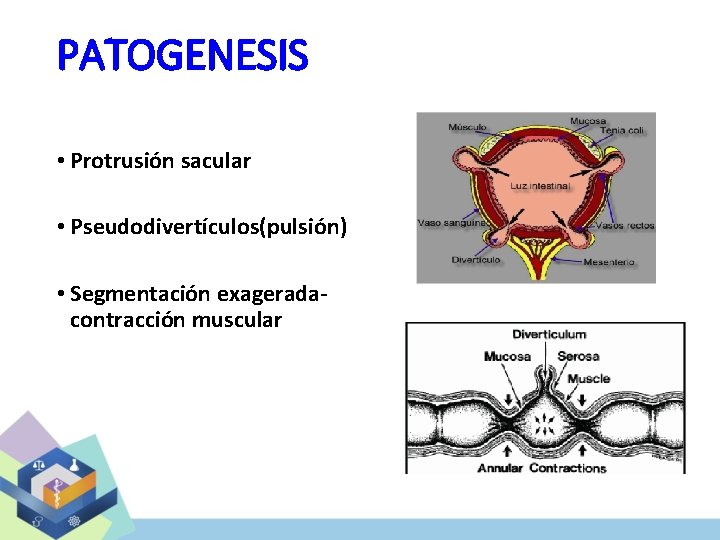 PATOGENESIS • Protrusión sacular • Pseudodivertículos(pulsión) • Segmentación exageradacontracción muscular 