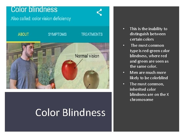  • • Color Blindness This is the inability to distinguish between certain colors