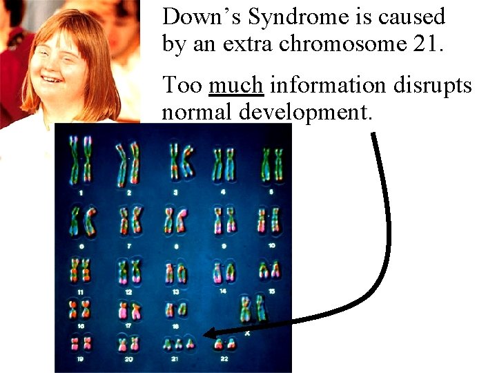 Down’s Syndrome is caused by an extra chromosome 21. Too much information disrupts normal