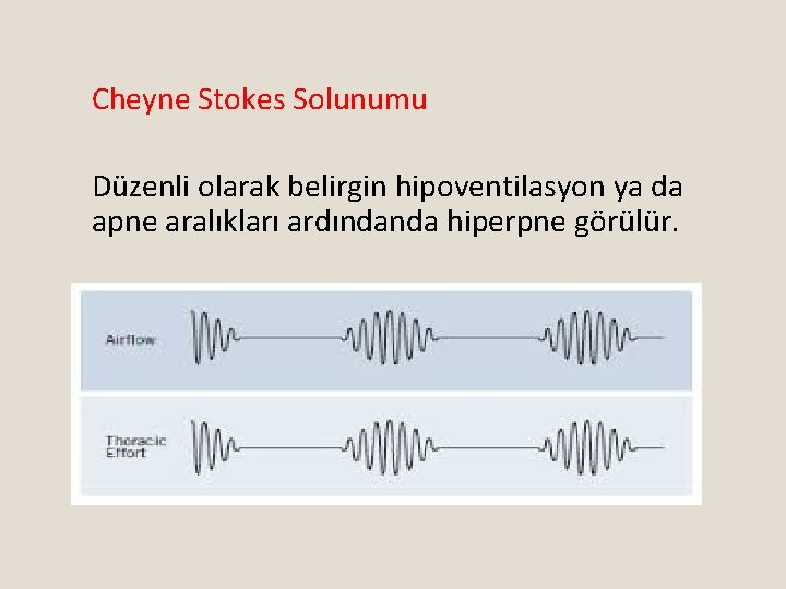 Cheyne Stokes Solunumu Düzenli olarak belirgin hipoventilasyon ya da apne aralıkları ardındanda hiperpne görülür.