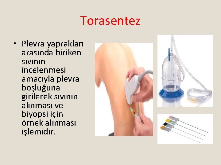 Torasentez • Plevra yaprakları arasında biriken sıvının incelenmesi amacıyla plevra boşluğuna girilerek sıvının alınması