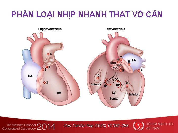 PH N LOẠI NHỊP NHANH THẤT VÔ CĂN Curr Cardiol Rep (2010) 12: 382–