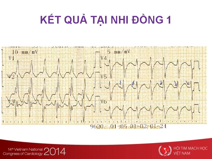 KẾT QUẢ TẠI NHI ĐỒNG 1 