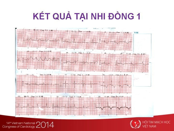 KẾT QUẢ TẠI NHI ĐỒNG 1 