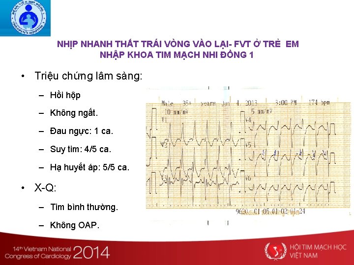 NHỊP NHANH THẤT TRÁI VÒNG VÀO LẠI- FVT Ở TRẺ EM NHẬP KHOA TIM