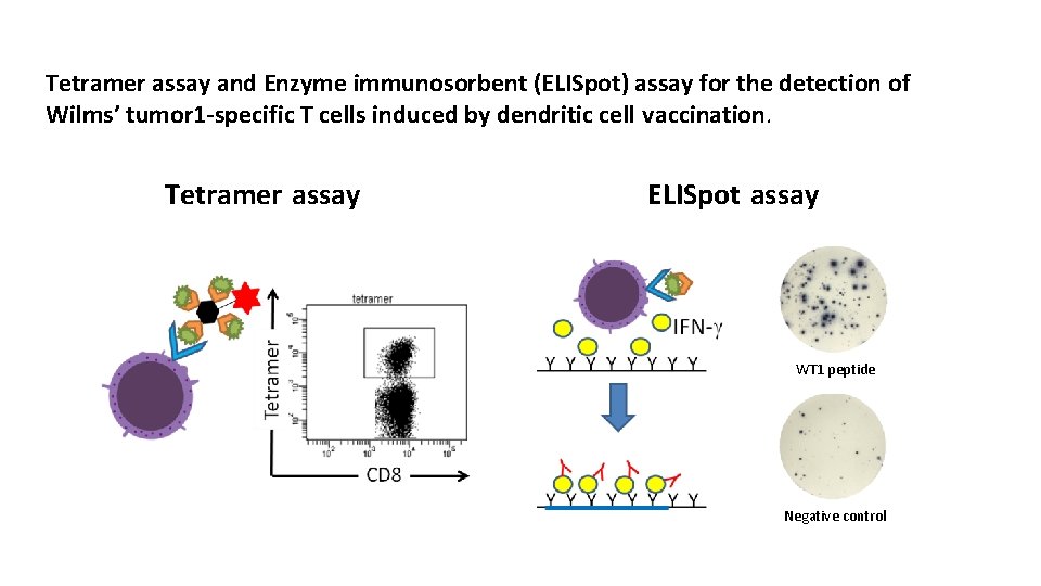 Tetramer assay and Enzyme immunosorbent (ELISpot) assay for the detection of Wilms’ tumor 1