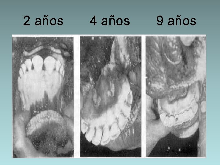 2 años 4 años 9 años 