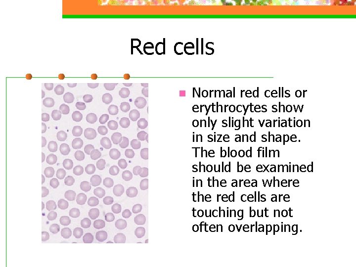 Red cells n Normal red cells or erythrocytes show only slight variation in size
