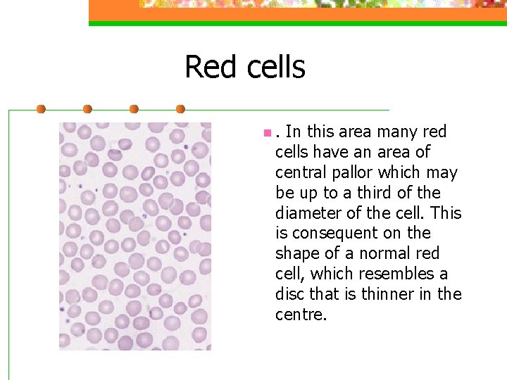 Red cells n. In this area many red cells have an area of central