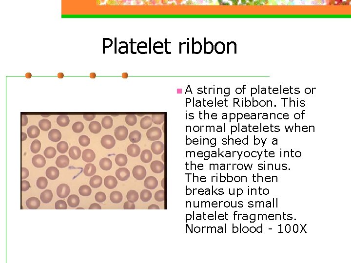 Platelet ribbon n. A string of platelets or Platelet Ribbon. This is the appearance