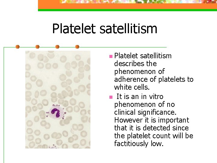Platelet satellitism n Platelet satellitism describes the phenomenon of adherence of platelets to white