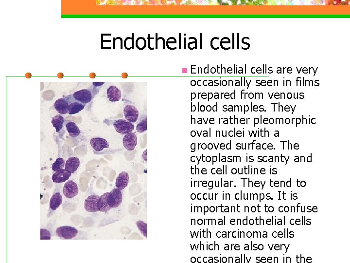 Endothelial cells n Endothelial cells are very occasionally seen in films prepared from venous
