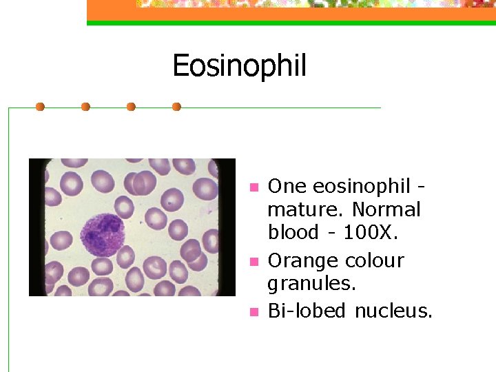 Eosinophil n n n One eosinophil mature. Normal blood - 100 X. Orange colour