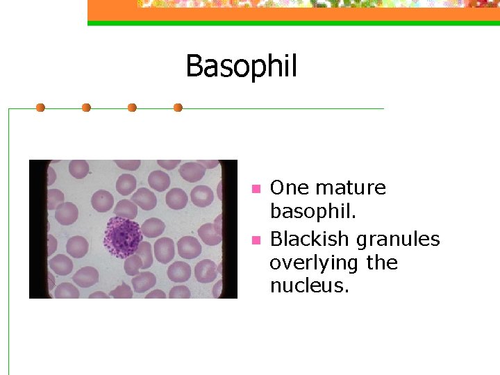 Basophil n n One mature basophil. Blackish granules overlying the nucleus. 