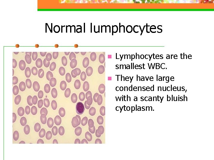 Normal lumphocytes n n Lymphocytes are the smallest WBC. They have large condensed nucleus,