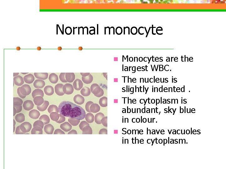 Normal monocyte n n Monocytes are the largest WBC. The nucleus is slightly indented.