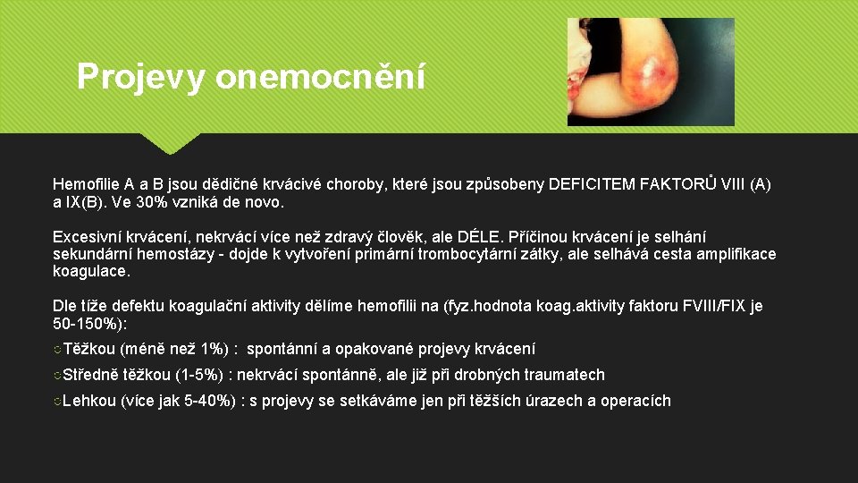 Projevy onemocnění Hemofilie A a B jsou dědičné krvácivé choroby, které jsou způsobeny DEFICITEM