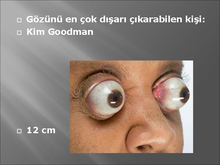  Gözünü en çok dışarı çıkarabilen kişi: Kim Goodman 12 cm 