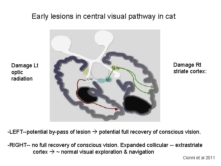 Early lesions in central visual pathway in cat Damage Lt optic radiation Damage Rt