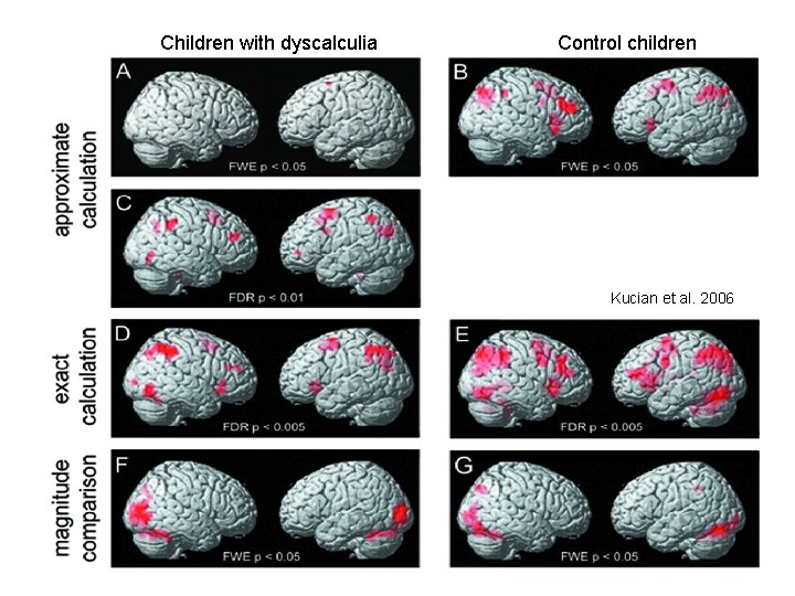 Children with dyscalculia Control children Kucian et al. 2006 