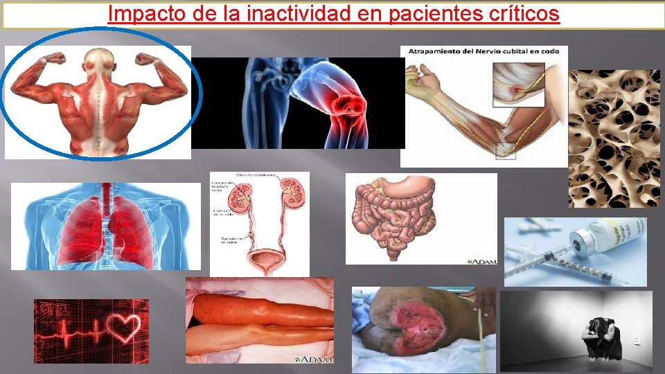 Impacto de la inactividad en pacientes críticos 