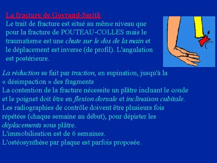 La fracture de Goyrand-Smith Le trait de fracture est situé au même niveau que