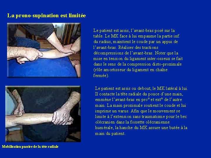La prono-supination est limitée Le patient est assis, l’avant-bras posé sur la table. Le