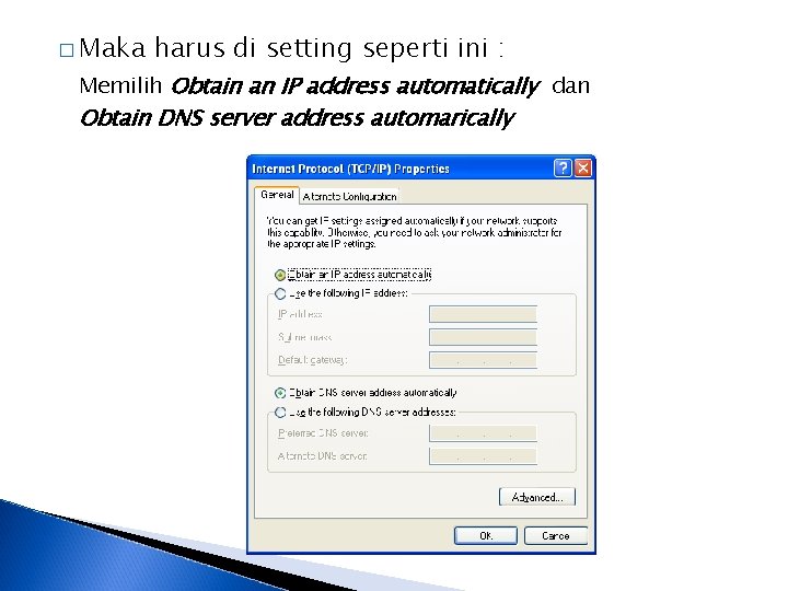 � Maka harus di setting seperti ini : Memilih Obtain an IP address automatically