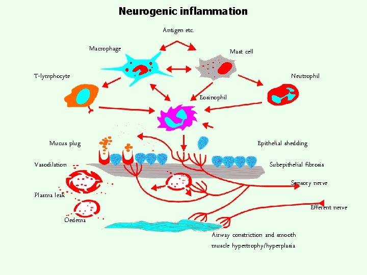 Neurogenic inflammation Antigen etc. Macrophage Mast cell T-lymphocyte Neutrophil Eosinophil Mucus plug Vasodilation Plasma