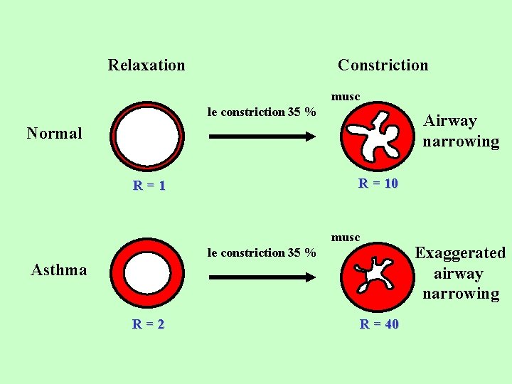 Relaxation Constriction musc le constriction 35 % Airway narrowing Normal R = 10 R=1