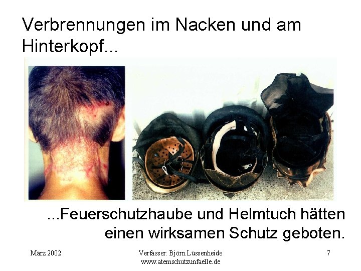 Verbrennungen im Nacken und am Hinterkopf. . . Feuerschutzhaube und Helmtuch hätten einen wirksamen