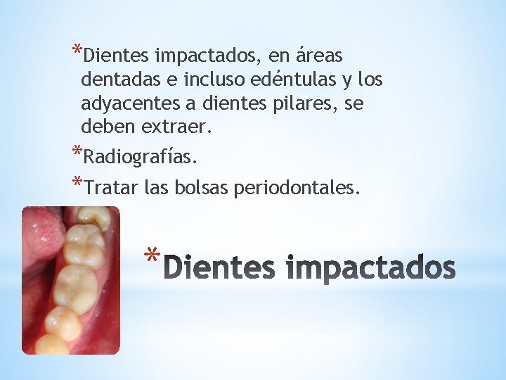 *Dientes impactados, en áreas dentadas e incluso edéntulas y los adyacentes a dientes pilares,