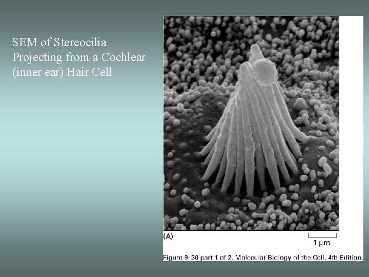 SEM of Stereocilia Projecting from a Cochlear (inner ear) Hair Cell 