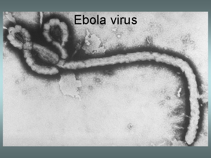 Ebola virus 