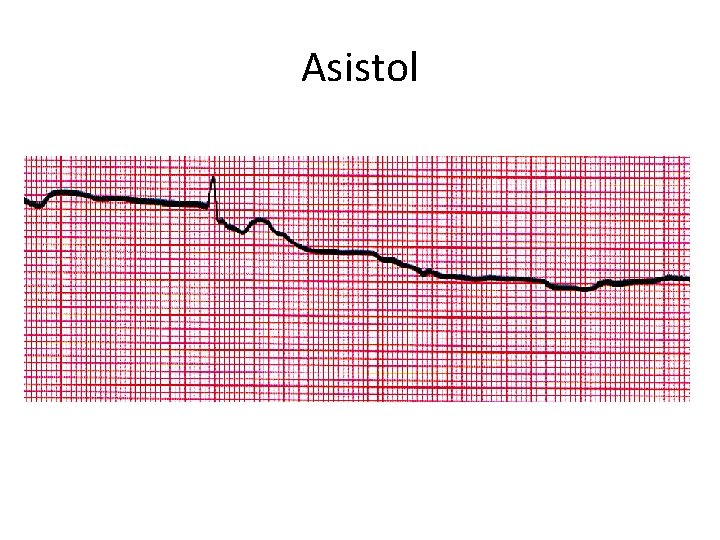 Asistol 