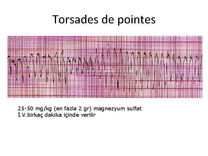 Torsades de pointes 25 -50 mg/kg (en fazla 2 gr) magnezyum sulfat İ. V.
