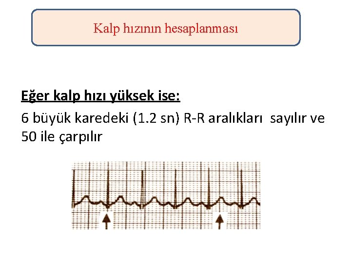 Kalp hızının hesaplanması Eğer kalp hızı yüksek ise: 6 büyük karedeki (1. 2 sn)