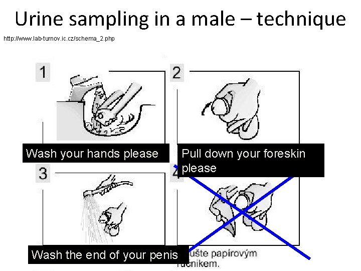 Urine sampling in a male – technique http: //www. lab-turnov. ic. cz/schema_2. php Wash