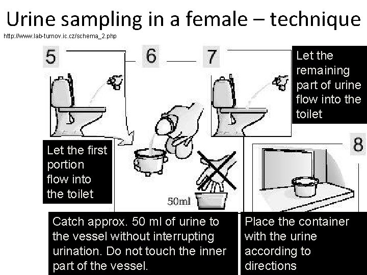 Urine sampling in a female – technique http: //www. lab-turnov. ic. cz/schema_2. php Let