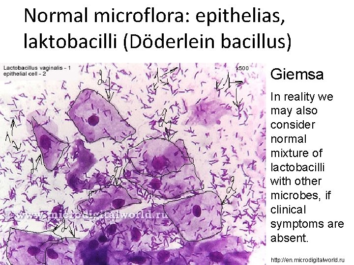 Normal microflora: epithelias, laktobacilli (Döderlein bacillus) Giemsa In reality we may also consider normal