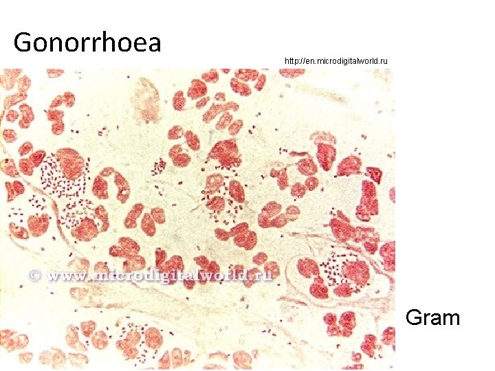 Gonorrhoea http: //en. microdigitalworld. ru Gram 