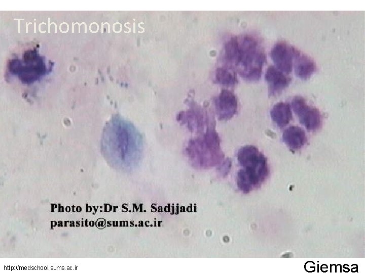 Trichomonosis http: //medschool. sums. ac. ir Giemsa 
