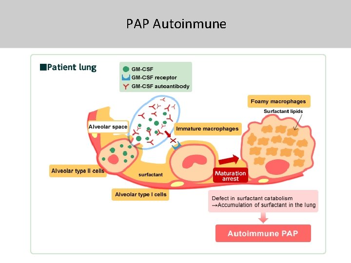 PAP Autoinmune 