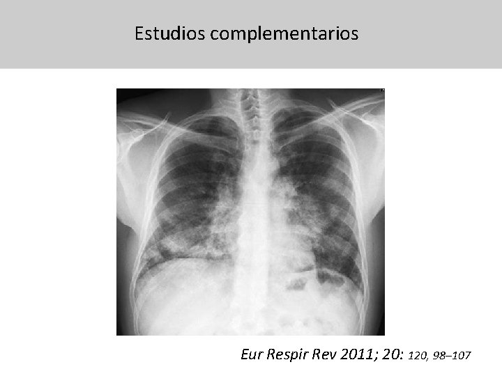 Estudios complementarios 31/07/13 Eur Respir Rev 2011; 20: 120, 98– 107 