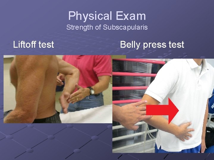 Physical Exam Strength of Subscapularis Liftoff test Belly press test 