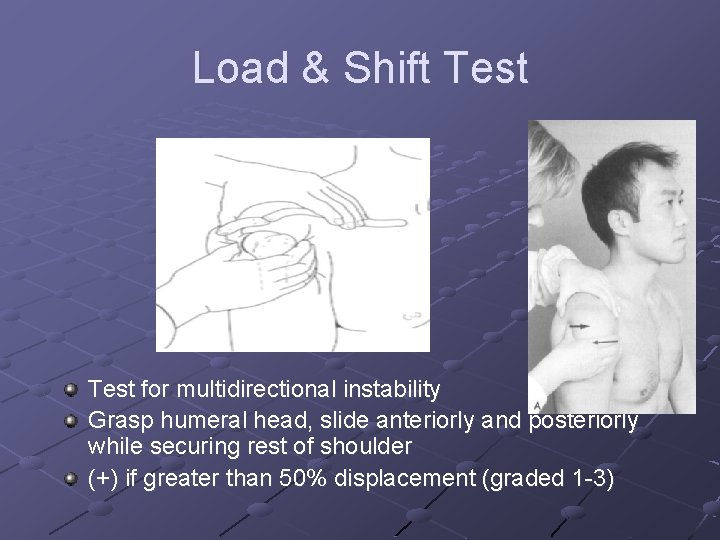 Load & Shift Test for multidirectional instability Grasp humeral head, slide anteriorly and posteriorly