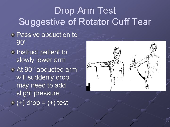 Drop Arm Test Suggestive of Rotator Cuff Tear Passive abduction to 90° Instruct patient
