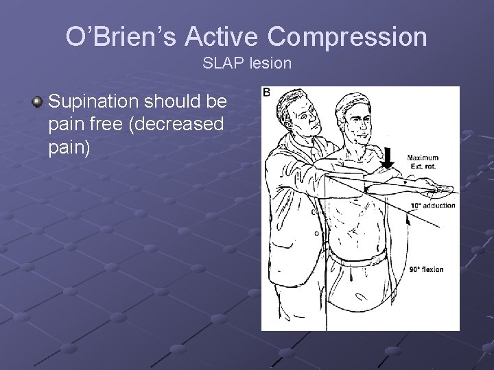 O’Brien’s Active Compression SLAP lesion Supination should be pain free (decreased pain) 