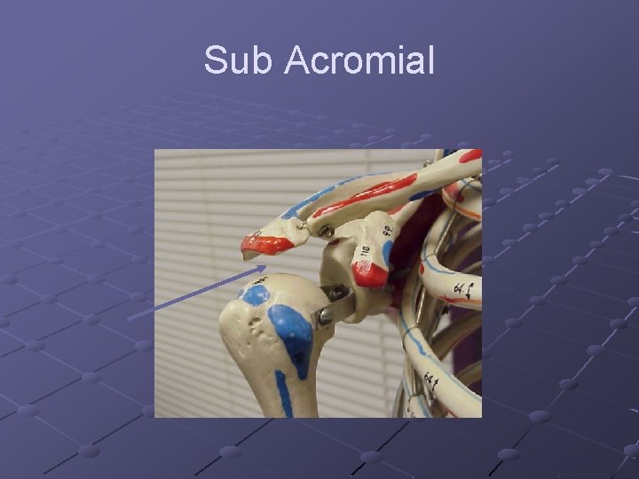 Sub Acromial 